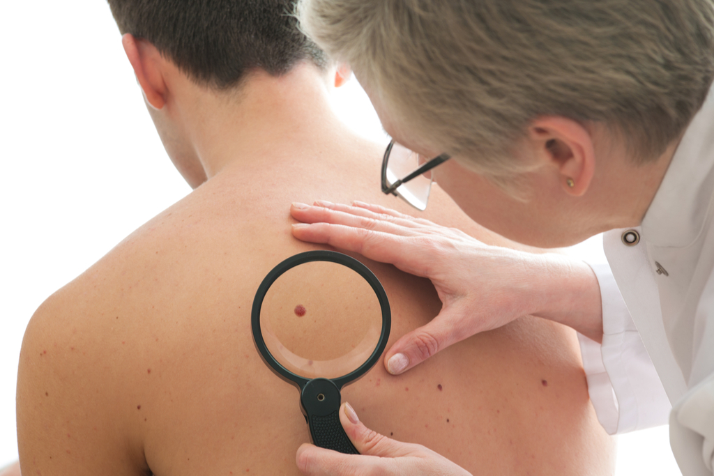 Man with Skin Cancer Diseases That Affect Men men's health concerns over 40