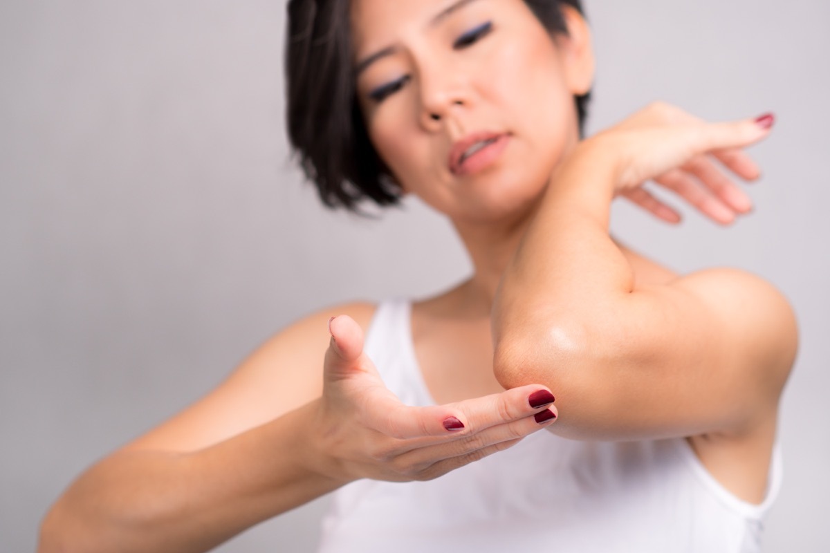 woman applying daily skin care lotion, moisturizer cream, on her elbow. Rough and dry skin