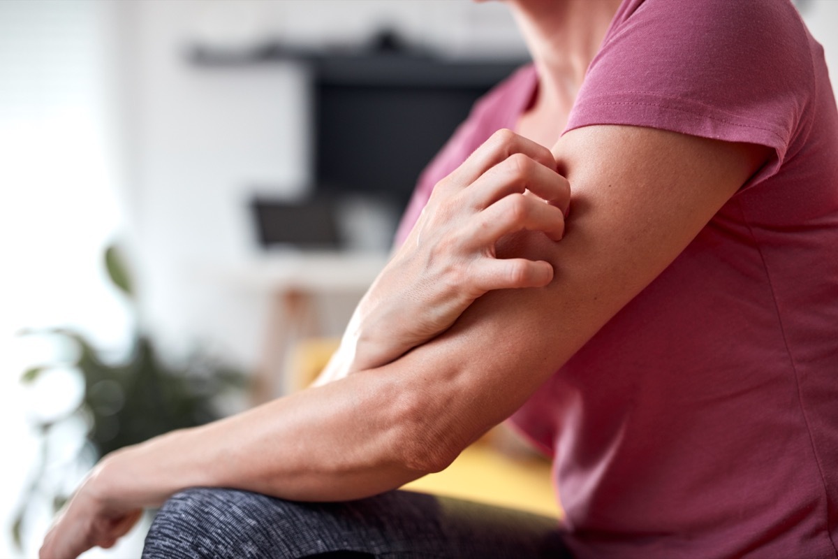 Woman with itchy, tingling arms scratching skin.