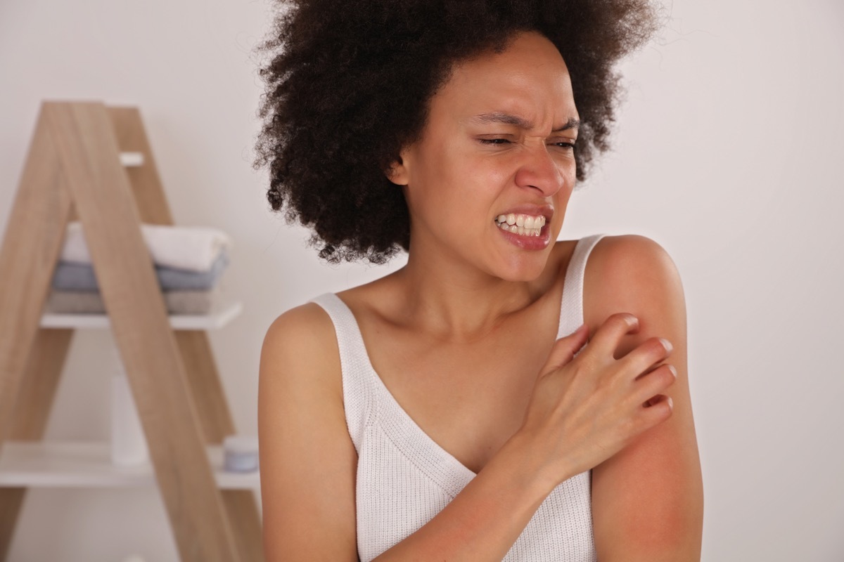 A woman appears to have allergic reaction, itchy arm