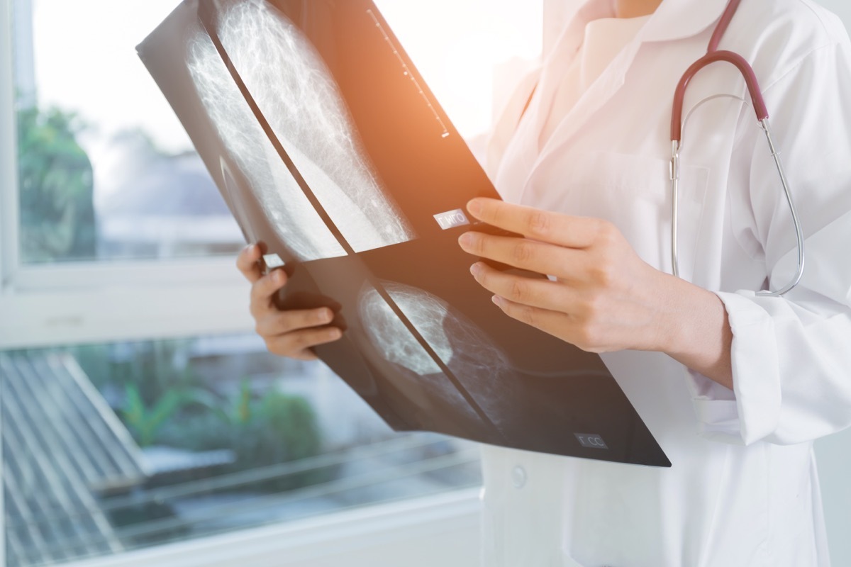 Doctor looking at a mammogram